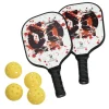 Onix Recruit Composite Pickleball Set